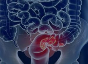 Crédito: agenciabrasil.ebc.com.br